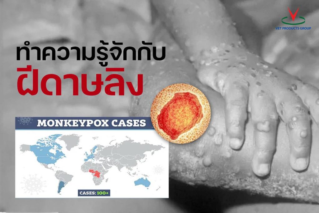โรคฝีดาษลิง (Monkeypox) by Dr.Peen iTAC